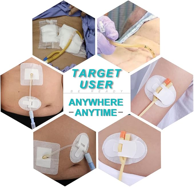 Peritoneal Dialysis PD Catheter Holder for Stomach Feeding Peg J Tube G-Tube Urine Foley Catheter Stabilization Device Urinary Leg Bag Holder Dressing (Pack of 20)
