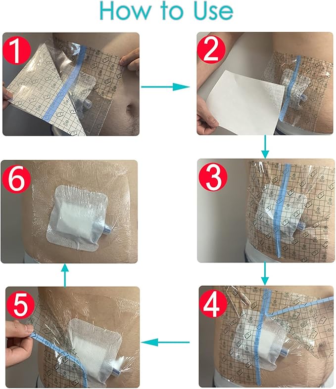 Waterproof Shower Cover Shields for Dialysis Port Picc Line Chest Catheter PD Peritoneal Dialysis Chemo Port Feeding Tube Shower Protector 10" x 10" (Pack of 25)