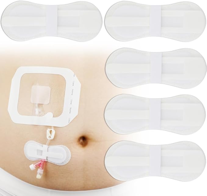 Low-Profile Catheter Stabilization Device for Kids Baby's Gtube Feeding Tube G J Tube Peg Pd Catheter Holder Peritoneal Dialysis Accessories Adhesive Patch Dressing (Pack of 15)