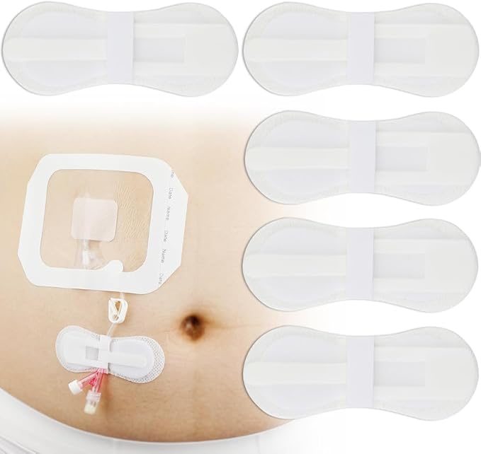 Low-Profile Catheter Stabilization Device for Kids Baby's Gtube Feeding Tube G J Tube Peg Pd Catheter Holder Peritoneal Dialysis Accessories Adhesive Patch Dressing (Pack of 20)