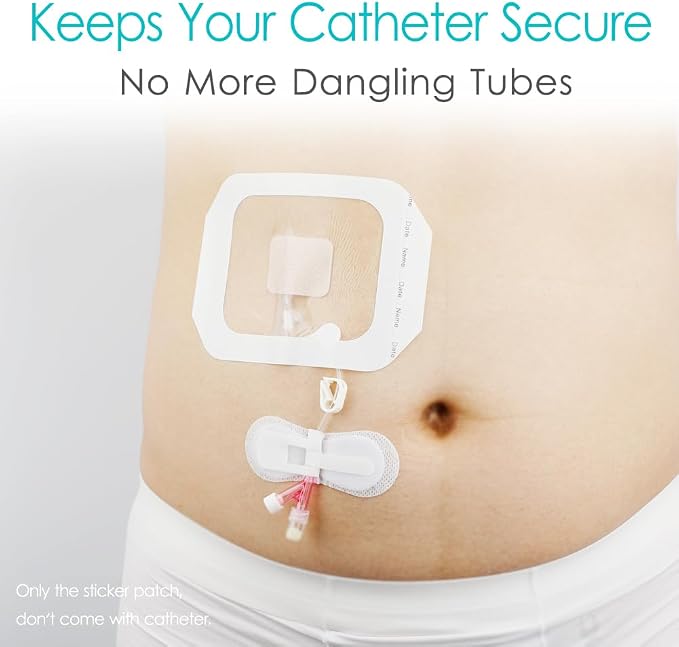 Low-Profile Catheter Stabilization Device for Kids Baby's Gtube Feeding Tube G J Tube Peg Pd Catheter Holder Peritoneal Dialysis Accessories Adhesive Patch Dressing (Pack of 15)
