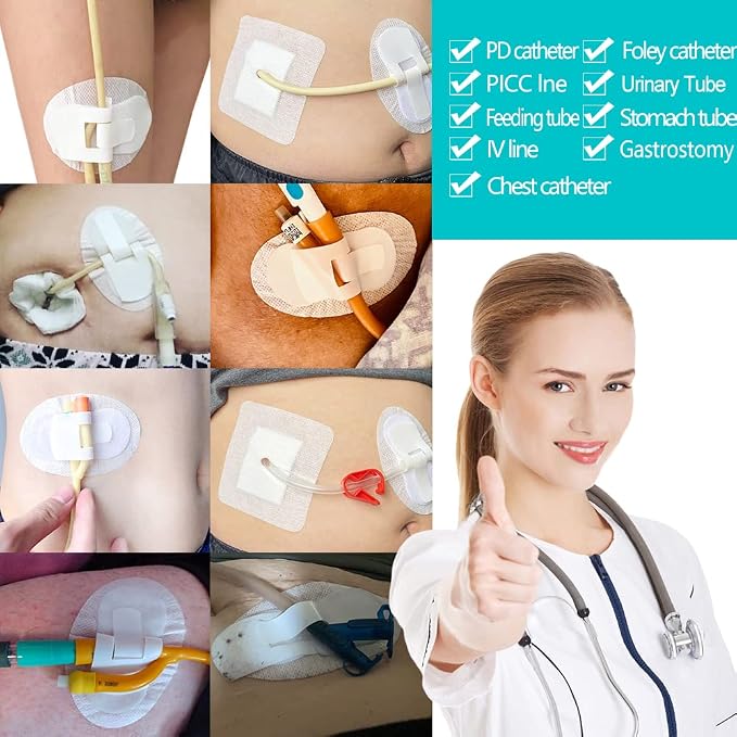 Low-Profile Catheter Stabilization Device for Kids Baby's Gtube Feeding Tube G J Tube Peg Pd Catheter Holder Peritoneal Dialysis Accessories Adhesive Patch Dressing (Pack of 10)