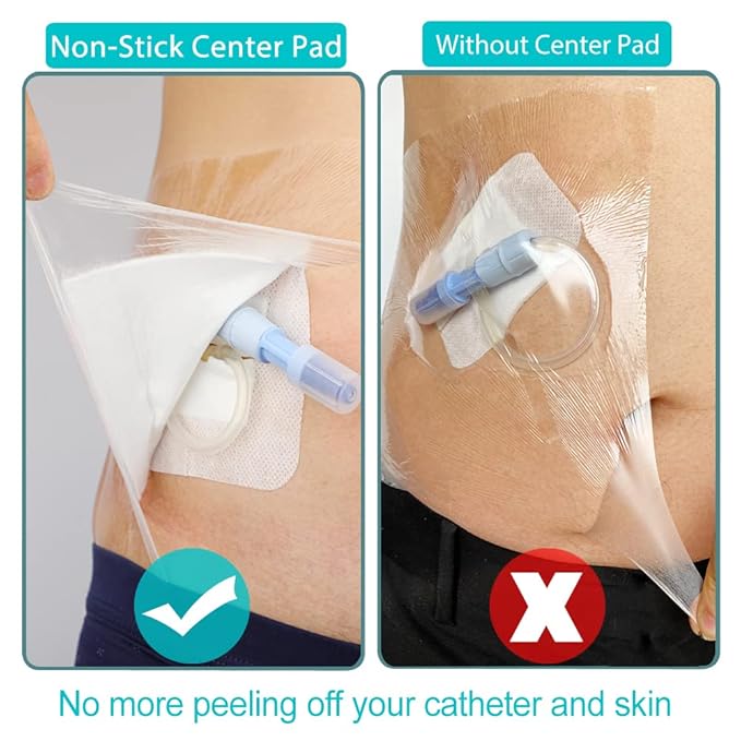 Waterproof Dialysis Catheter Shower Cover PD Catheter Shower Protector Shields with Non-Stick Center Pad for Peritoneal Dialysis Accessories Port Chest Central Line 6"x6" Pack of 25