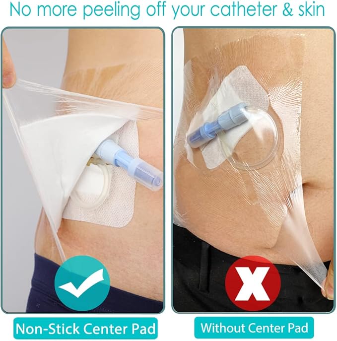 Waterproof Shower Cover Shields Dialysis Port Picc Line Chest Catheter PD Peritoneal Dialysis Chemo, Non-Stick Center Pad forFeeding Tube Peg G-Tube Patient Bandage Protector, 12"x12"(Pack of 14)