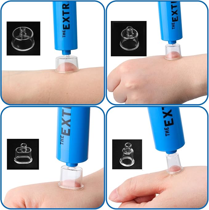Snake Bite Kit, Bee Sting Kit, Emergency First Aid Supplies, Venom Extractor Suction Pump, Bite and Sting First Aid for Hiking, Backpacking and Camping. Includes Bonus CPR face Shield (Blue)