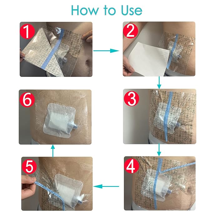 Waterproof Dialysis Catheter Shower Cover Large Coverage Shields for Peritoneal Dialysis Port Accessories PD Chest Catheter Central PICC Line Feeding Tube 10"x12"(Pack of 25)