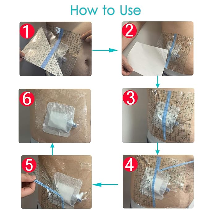 Waterproof Dialysis Catheter Shower Cover PD Catheter Shower Protector Shields with Non-Stick Center Pad for Peritoneal Dialysis Accessories Port Chest Central Line 6"x6" Pack of 25